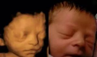 胎儿四维彩超照片 胎儿四维彩超照片